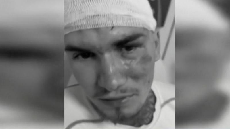 Richárdot brutálisan összeverték egy borsodi házibulin, és a házigazda megdöbbentő kijelentéseket tett az esetről – nézd meg a videót!
